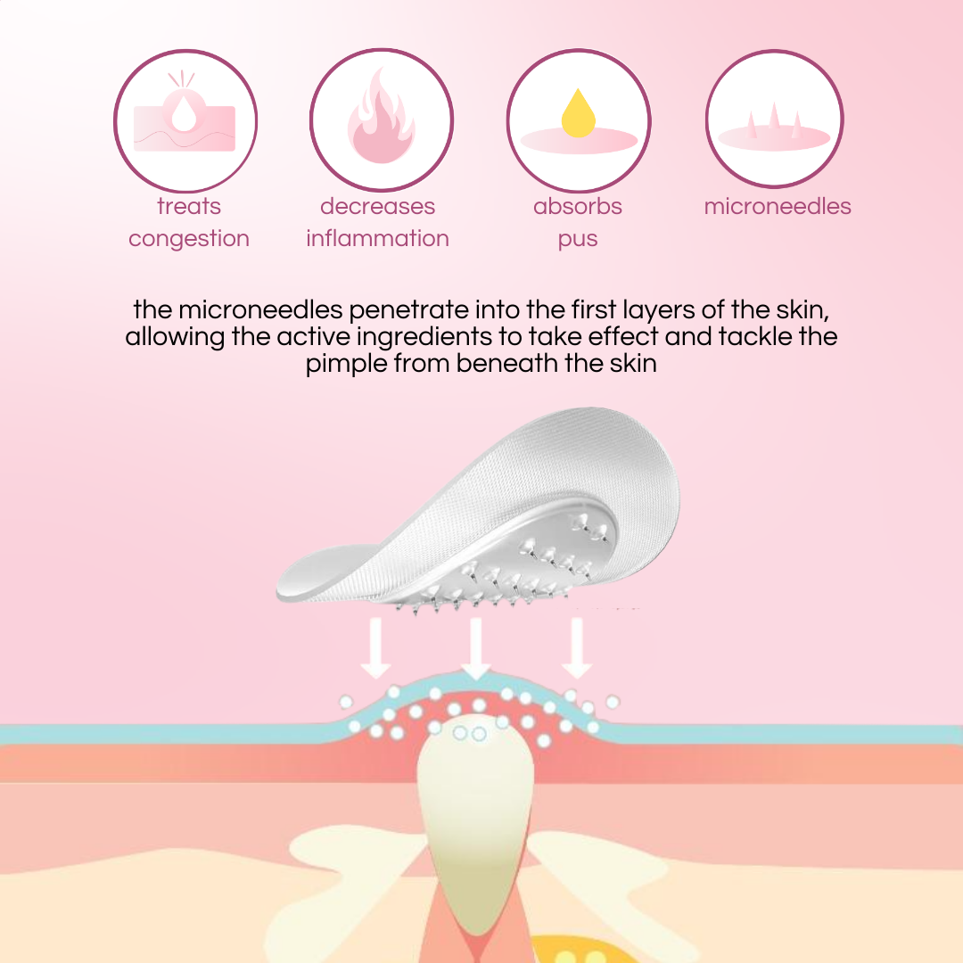 Microneedle Acne - Pimple Patch