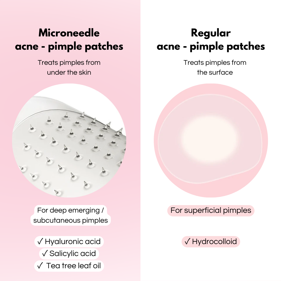 Microneedle Acne - Pimple Patch